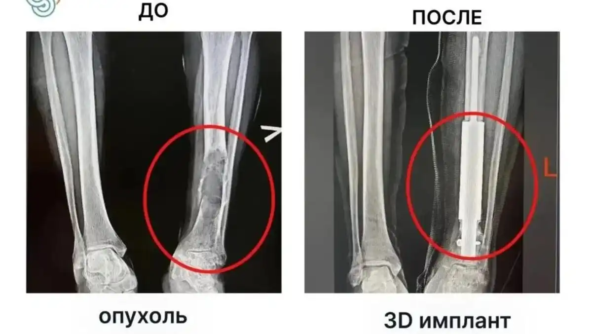 снимок рентген ноги