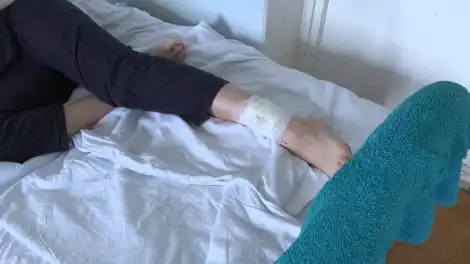 нога укус больница пациент перевязка