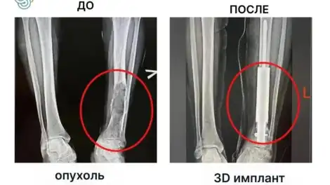 снимок рентген ноги