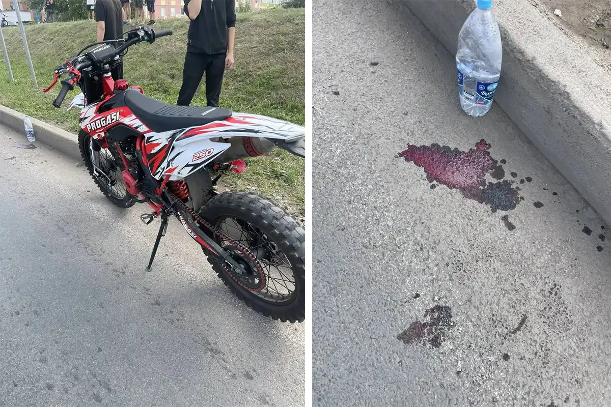 питбайк и кровь